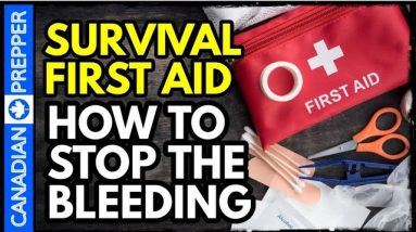 Every Prepper Must Know This: How to Stop Bleeding